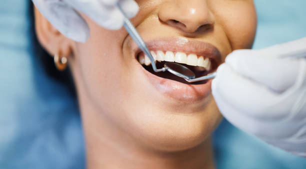 Best Emergency Treatment for Dental Infections or Abscesses in Canon, GA